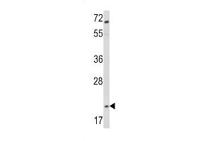 Western blot analysis of Glucagon Antibody (C-term) (ABIN390769 and ABIN2841027) in Jurkat cell line lysates (35 μg/lane). (Glucagon antibody  (C-Term))