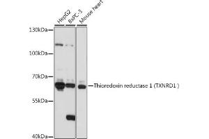 Western blot analysis of extracts of various cell lines, using Thioredoxin reductase 1 (Thioredoxin reductase 1 (TXNRD1 ) ) antibody (ABIN7270806) at 1:1000 dilution. (TXNRD1 antibody)