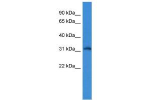 WB Suggested Anti-KCNIP4 Antibody Titration: 0. (KCNIP4 antibody  (N-Term))