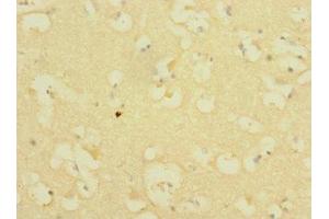 Immunohistochemistry of paraffin-embedded human brain tissue using ABIN7156544 at dilution of 1:100