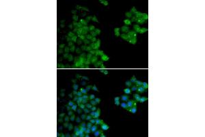 Immunofluorescence analysis of HeLa cells using PSMB10 antibody (ABIN6132527, ABIN6146311, ABIN6146312 and ABIN6221107). (PSMB10 antibody  (AA 1-273))