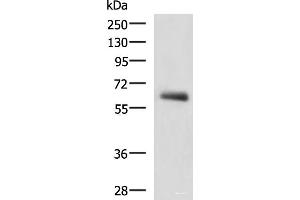 Western blot analysis of Human metastatic papillary carcinoma(thyroid cancer) tissue lysate using KBTBD11 Polyclonal Antibody at dilution of 1:2300 (KBTBD11 antibody)