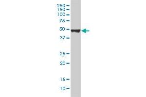 KRT20 monoclonal antibody (M01), clone 2G3-1C8 Western Blot analysis of KRT20 expression in A-431 . (KRT20 antibody  (AA 1-424))