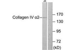 Western Blotting (WB) image for anti-Collagen, Type IV, alpha 2 (COL4A2) (AA 151-200) antibody (ABIN2889911) (COL4a2 antibody  (AA 151-200))