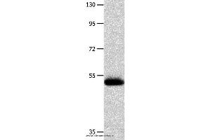 Western blot analysis of Human endometrial carcinoma tissue  , using MMP10 Polyclonal Antibody at dilution of 1:200 (MMP10 antibody)