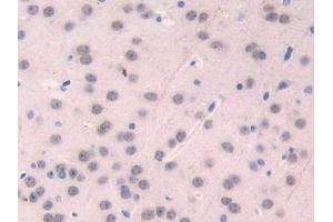 Detection of CD15 in Mouse Brain Tissue using Polyclonal Antibody to Cluster Of Differentiation 15 (CD15)