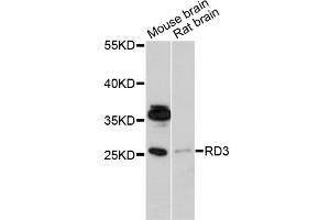 Western blot analysis of extracts of various cell lines, using RD3 antibody (ABIN6294071) at 1:1000 dilution. (RD3 antibody)