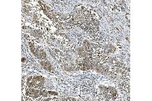 IHC analysis of PTGS2 using anti-PTGS2 antibody (ABIN7600352).