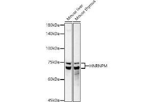 Western blot analysis of extracts of various cell lines, using HNRNPM antibody (ABIN7267635) at 1:1000 dilution. (HNRNPM antibody)