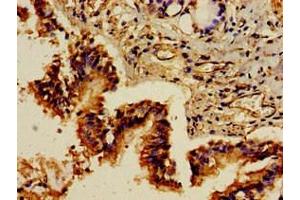 Immunohistochemistry of paraffin-embedded human lung tissue using ABIN7154494 at dilution of 1:100 (PIK3R1 antibody  (AA 15-180))