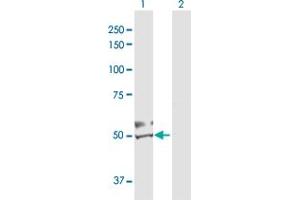 Western Blot analysis of DBT expression in transfected 293T cell line by DBT MaxPab polyclonal antibody. (DBT antibody  (AA 1-482))