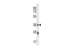 PLSCR4 Antibody (Center) (ABIN657895 and ABIN2846847) western blot analysis in mouse stomach tissue lysates (35 μg/lane). (PLSCR4 antibody  (AA 122-151))