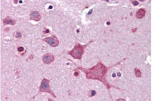 ABIN185398 (3. (DPP10 antibody  (Internal Region))