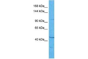 Host:  Rabbit  Target Name:  PRDM9  Sample Tissue:  Human 786-0 Whole Cell  Antibody Dilution:  1ug/ml