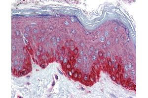 Immunohistochemistry (IHC) image for anti-Frizzled Family Receptor 4 (FZD4) (Middle Region) antibody (ABIN2776715) (FZD4 antibody  (Middle Region))