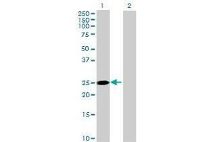 Lane 1: TMEM41B transfected lysate ( 21. (TMEM41B 293T Cell Transient Overexpression Lysate(Denatured))