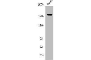 Western Blot analysis of HuvEc cells using ABCA8 Polyclonal Antibody (ABCA8 antibody  (Internal Region))