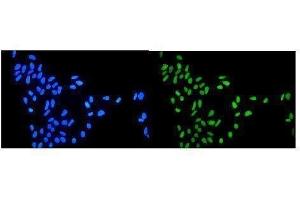 anti-Topoisomerase (DNA) I (TOP1) (AA 526-765) antibody