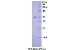 SDS-PAGE (SDS) image for Ceruloplasmin (Ferroxidase) (CP) (AA 789-1065) protein (His tag) (ABIN2120789)