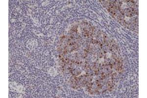 Immunohistochemical staining (Formalin-fixed paraffin-embedded sections) of human tonsil with AURKB monoclonal antibody, clone RM278 . (Aurora Kinase B antibody  (N-Term))