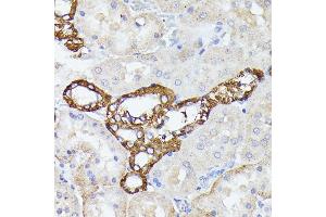 Immunohistochemistry of paraffin-embedded rat kidney using LTF antibody (ABIN6131498, ABIN6143382, ABIN6143383 and ABIN6216705) at dilution of 1:100 (40x lens). (Lactoferrin antibody  (AA 500-710))
