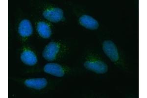 IF analysis of ZNRF3 using anti-ZNRF3 antibody (ABIN7602004). (ZNRF3 antibody  (AA 54-913))