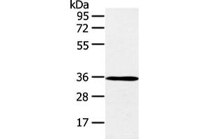 Western blot analysis of K562 cell and mouse brain tissue using E2F5 Polyclonal Antibody at dilution of 1:400 (E2F5 antibody)
