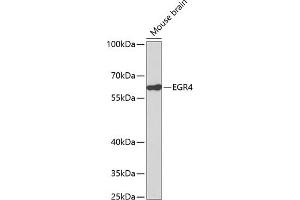 Western blot analysis of extracts of mouse brain, using EGR4 antibody (ABIN3016963, ABIN3016964, ABIN3016965 and ABIN1679681). (EGR4 antibody)