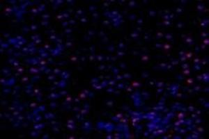 Immunofluorescent analysis of paraformaldehyde-fixed mouse kidney using,PNN (ABIN7075083) at dilution of 1: 800 (PNN antibody)