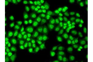 Immunofluorescence analysis of HeLa cells using GTF2F1 antibody (ABIN5971324). (GTF2F1 antibody)