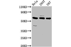 Western Blot Positive WB detected in: Hela whole cell lysate, 293T whole cell lysate, U87 whole cell lysate All lanes: NETO1 antibody at 3.