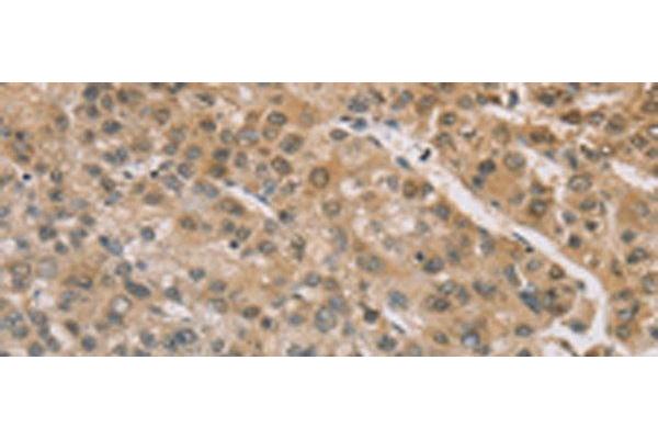 ZIC2 antibody