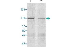 The tissue lysates derived from mouse heart (lane 1) or rat heart (lane 2) were immunoprobed by Corin polyclonal antibody  at 1 : 500. (Corin antibody  (N-Term))