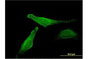 Immunofluorescence of monoclonal antibody to MB on HeLa cell. (Myoglobin antibody  (AA 2-100))