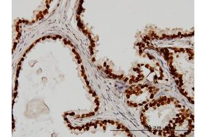 Immunostaining (ISt) image for anti-Forkhead Box A1 (FOXA1) (AA 367-472) antibody (ABIN561299)