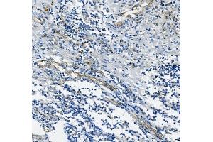 IHC analysis of CD31/PECAM1 using anti-CD31/PECAM1 antibody (ABIN7601076).