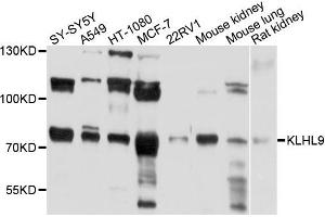 Western blot analysis of extracts of various cells, using KLHL9 antibody. (KLHL9 antibody)