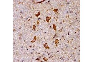 Pak7 antibody immunohistochemistry analysis in formalin fixed and paraffin embedded mouse brain tissue. (PAK7 antibody  (AA 128-157))