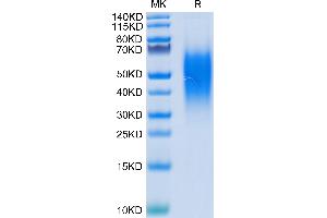 Human B7-H5 on Tris-Bis PAGE under reduced condition. (VTCN1 Protein (AA 33-194) (His tag))