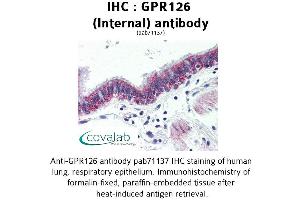 Image no. 2 for anti-G Protein-Coupled Receptor 126 (GPR126) (Internal Region) antibody (ABIN1734924) (G Protein-Coupled Receptor 126 antibody  (Internal Region))