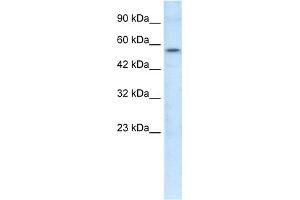 WB Suggested Anti-ETS1 Antibody Titration:  1. (ETS1 antibody  (N-Term))