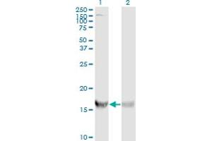 Western Blot analysis of RPS19 expression in transfected 293T cell line by RPS19 monoclonal antibody (M01A), clone 3C6.