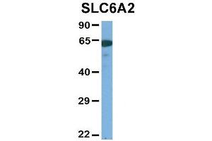 Host:  Rabbit  Target Name:  SLC6A2  Sample Type:  Human Adult Placenta  Antibody Dilution:  1. (SLC6A2 antibody  (Middle Region))
