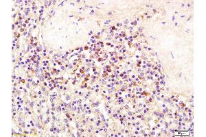 Formalin-fixed and paraffin embedded human spleen tissue labeled with Anti-SEMA4D/CD100 Polyclonal Antibody, Unconjugated (ABIN1387543) at 1:200 followed by conjugation to the secondary antibody and DAB staining