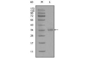 Western blot analysis using anti-CD45 monoclonal antibody against truncated CD45 recombinant protein (1). (CD45 antibody)