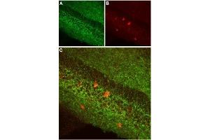 Expression of CB1 receptor in mouse hippocampusImmunohistochemical staining of mouse hippocampus using Anti-Cannabinoid Receptor 1 (extracellular) Antibody (ABIN7043023, ABIN7044155 and ABIN7044156), (1:100).