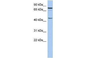 WB Suggested Anti-RNF169 Antibody Titration:  0.