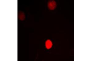 Immunofluorescent analysis of CTBP1 staining in HeLa cells. (CTBP1 antibody  (C-Term))