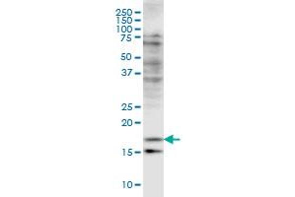 Cofilin 2 antibody  (AA 57-166)