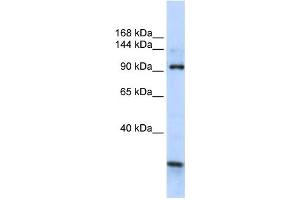 Western Blotting (WB) image for anti-KIAA1024 (KIAA1024) antibody (ABIN2459070) (KIAA1024 antibody)